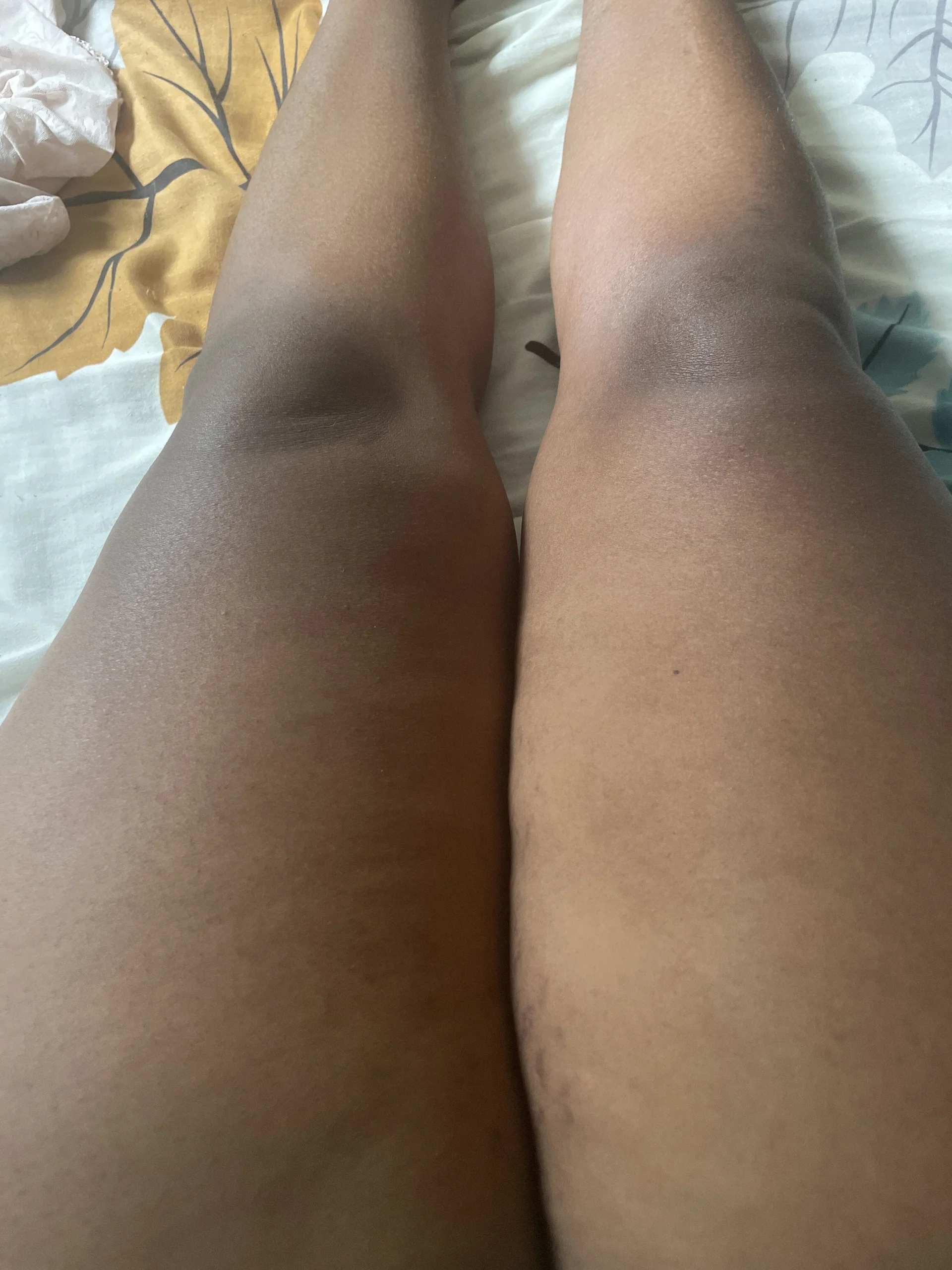XXX Porn Photo of Nude Happie22 1