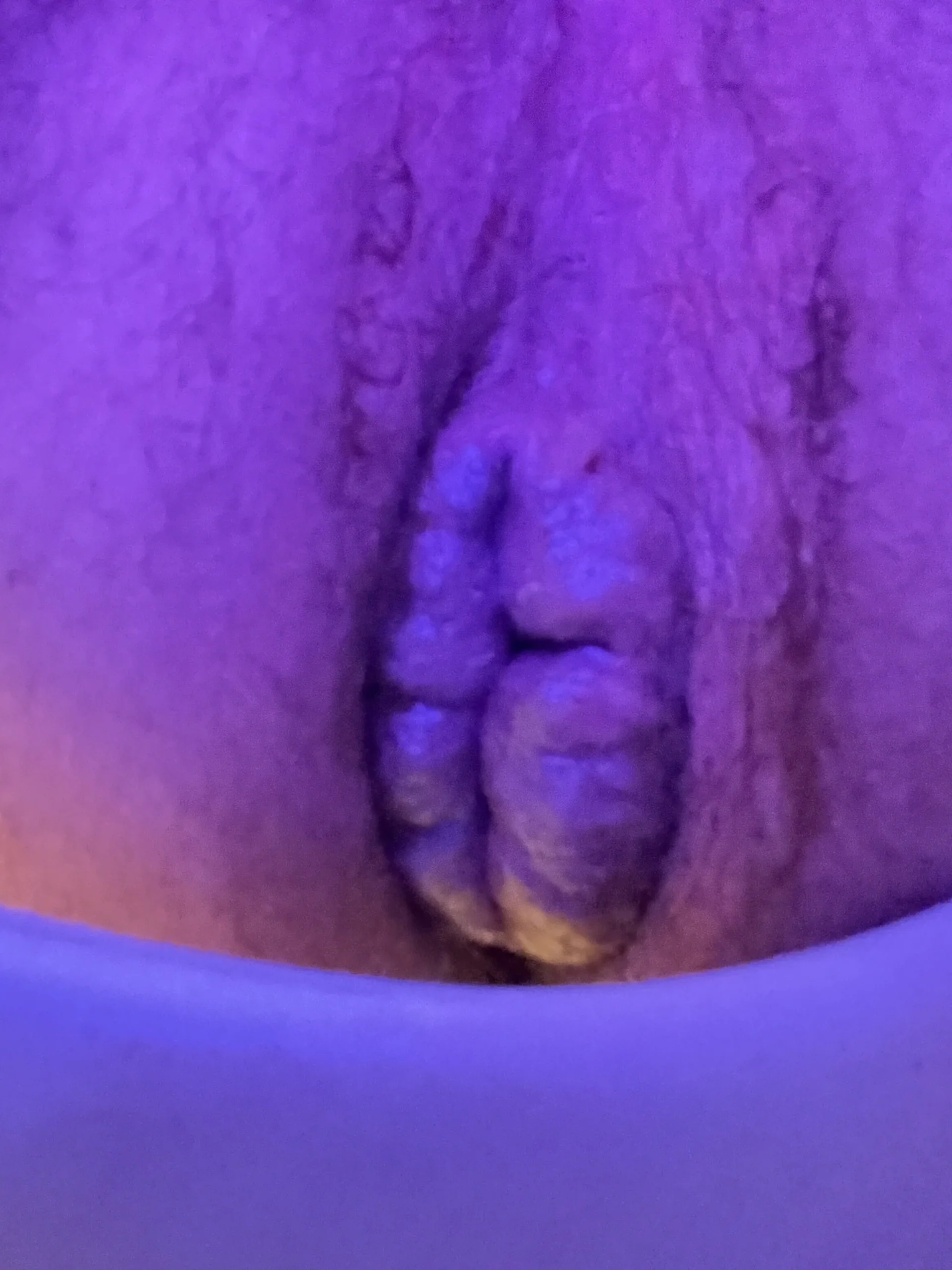 XXX Porn Photo of Nude FungodeBoy 4