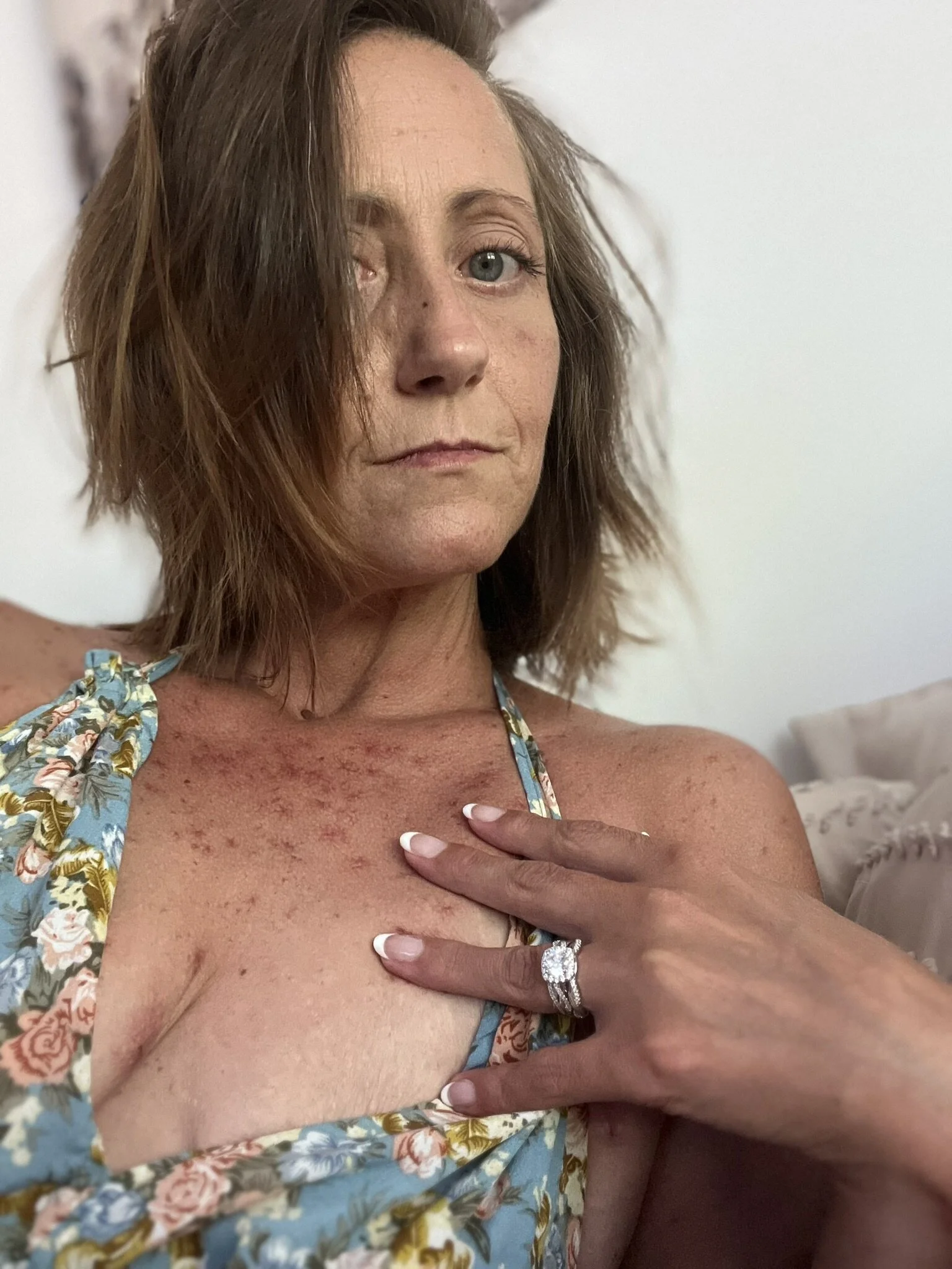 XXX Porn Photo of Nude MissFeralFox 25