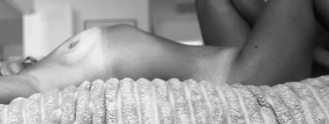 XXX Porn Photo of Nude MissFeralFox 41