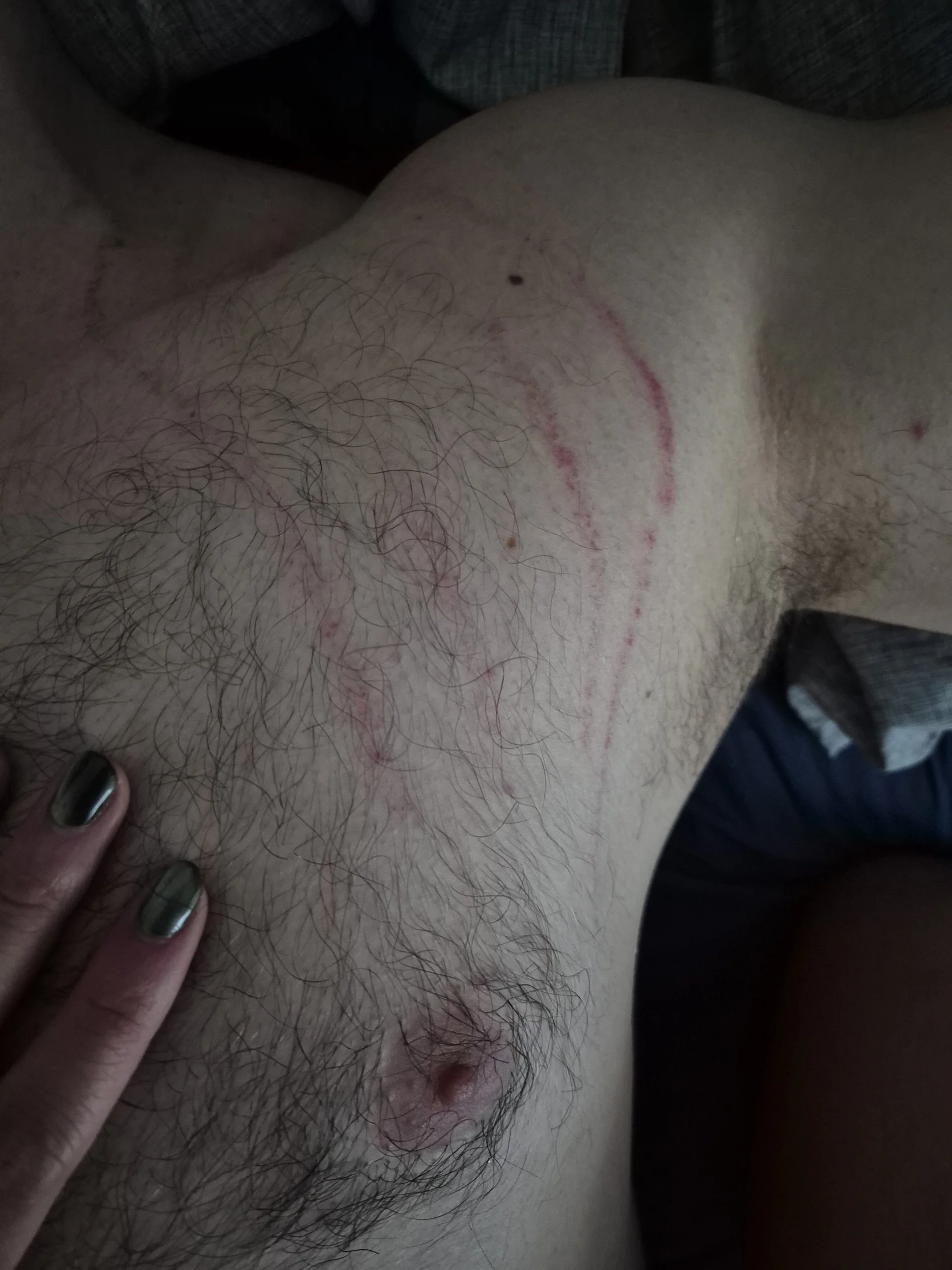 XXX Porn Photo of Nude AlexTeasse 2