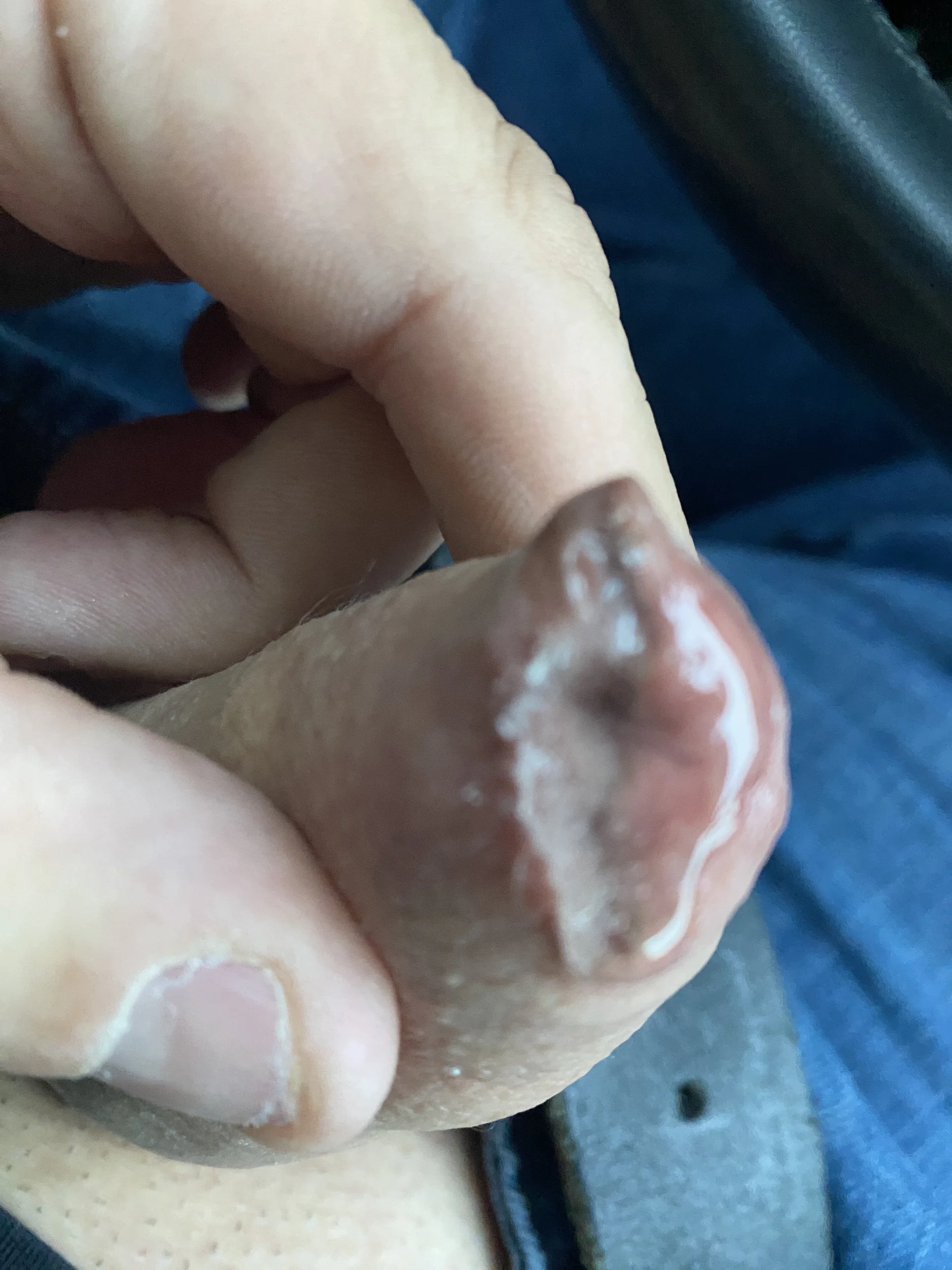 XXX Porn Photo of Nude Sklavekay 22