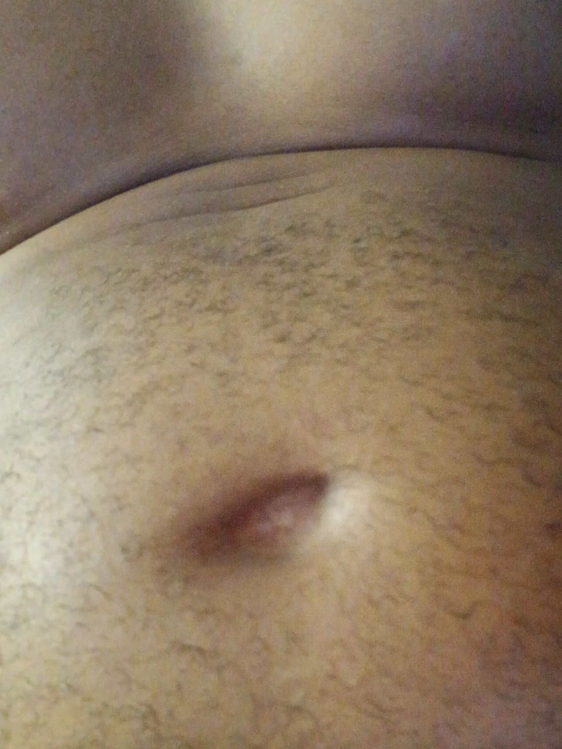 XXX Porn Photo of Nude chilibowl 1