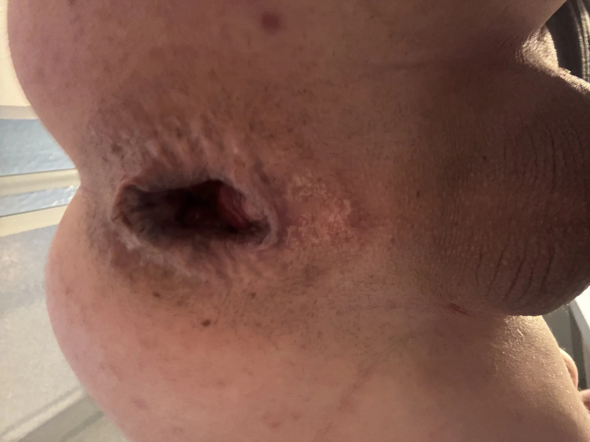 XXX Porn Photo of Nude JacsHole 2