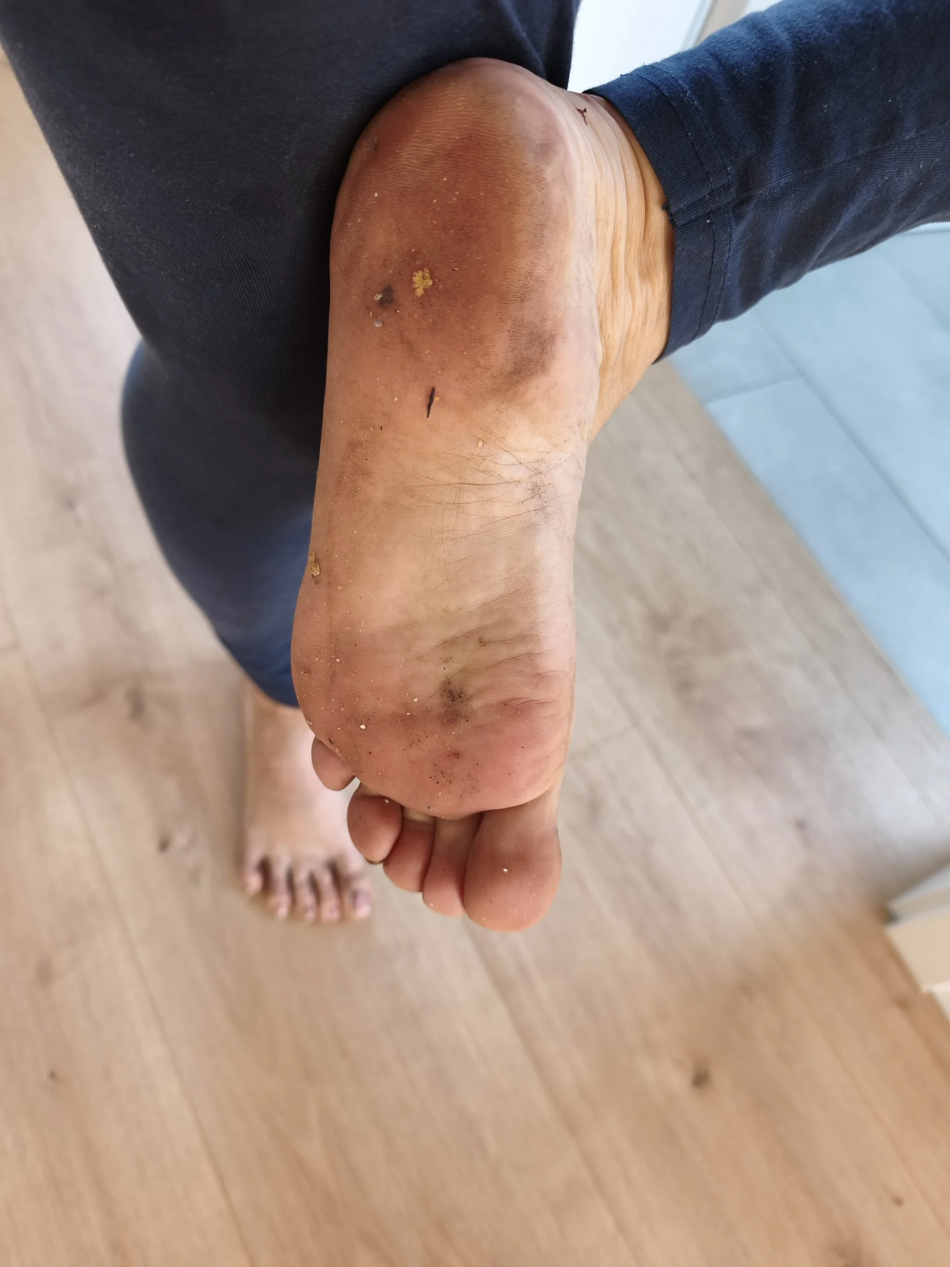 XXX Porn Photo of Nude Teafeet 5