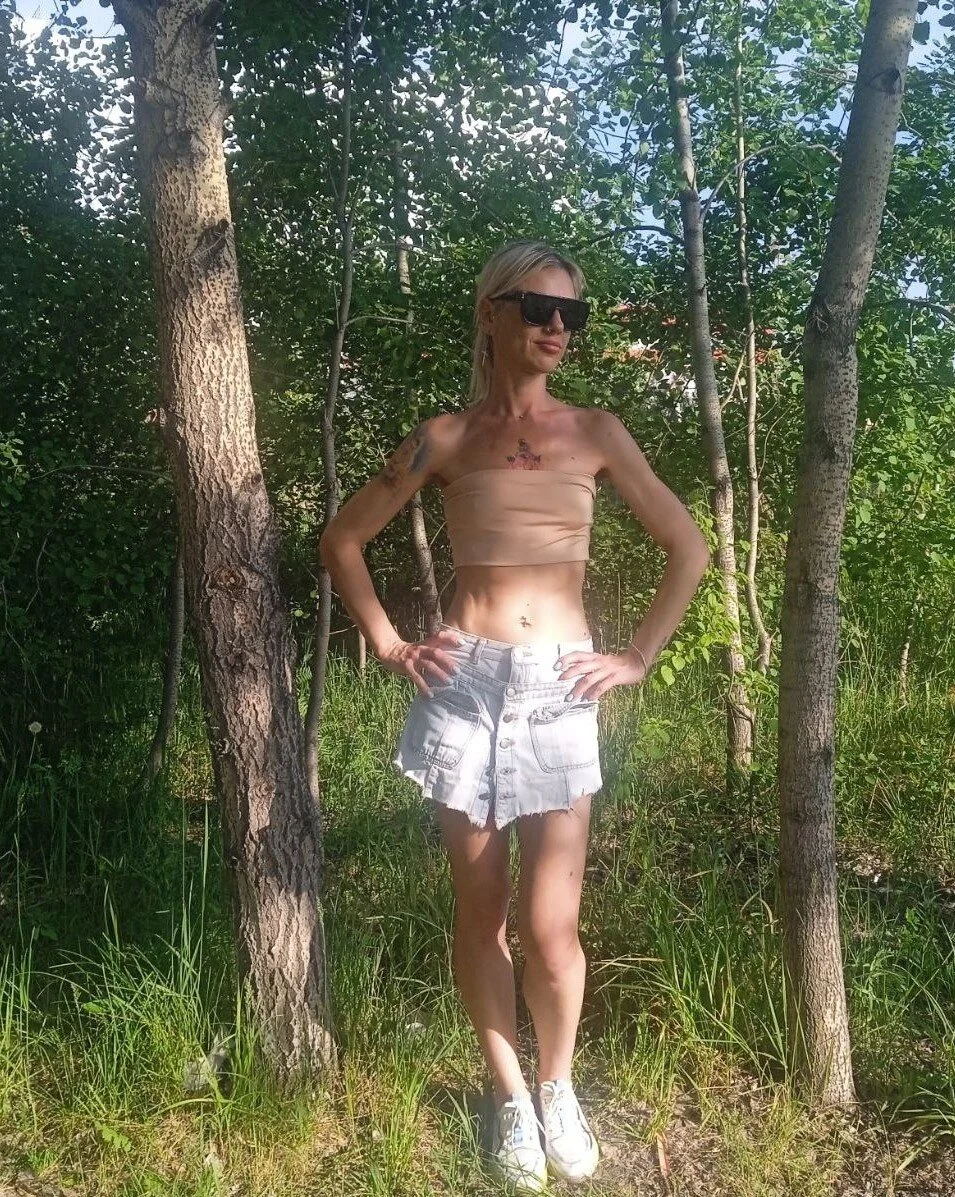 XXX Porn Photo of Nude Skinny_Nally 261