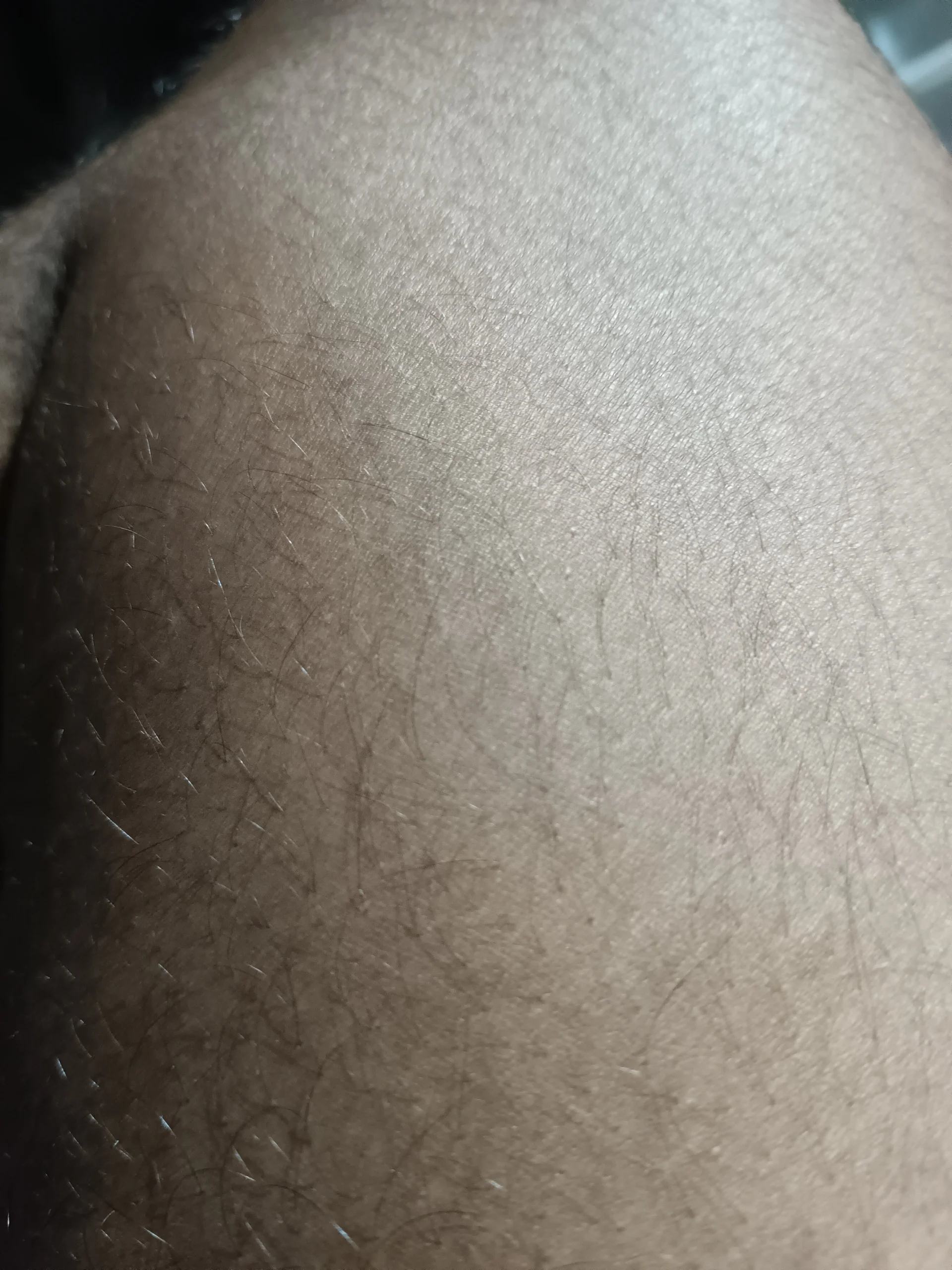 XXX Porn Photo of Nude RizzJosh 1