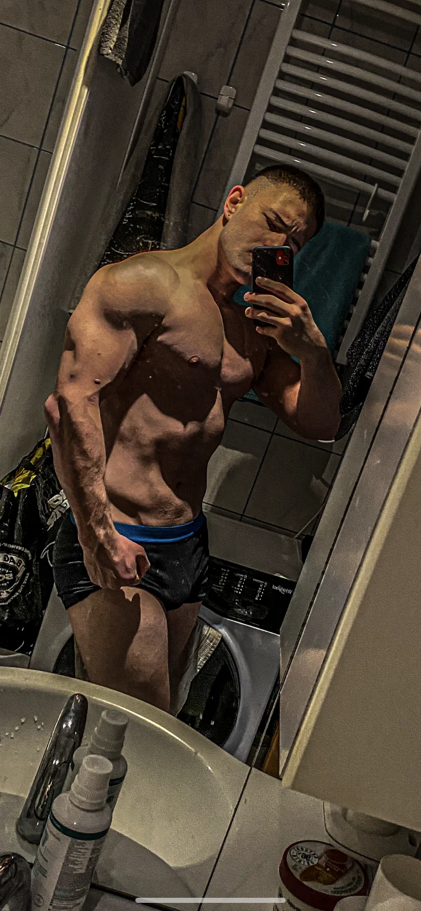 XXX Porn Photo of Nude vitiligoDaiv 10