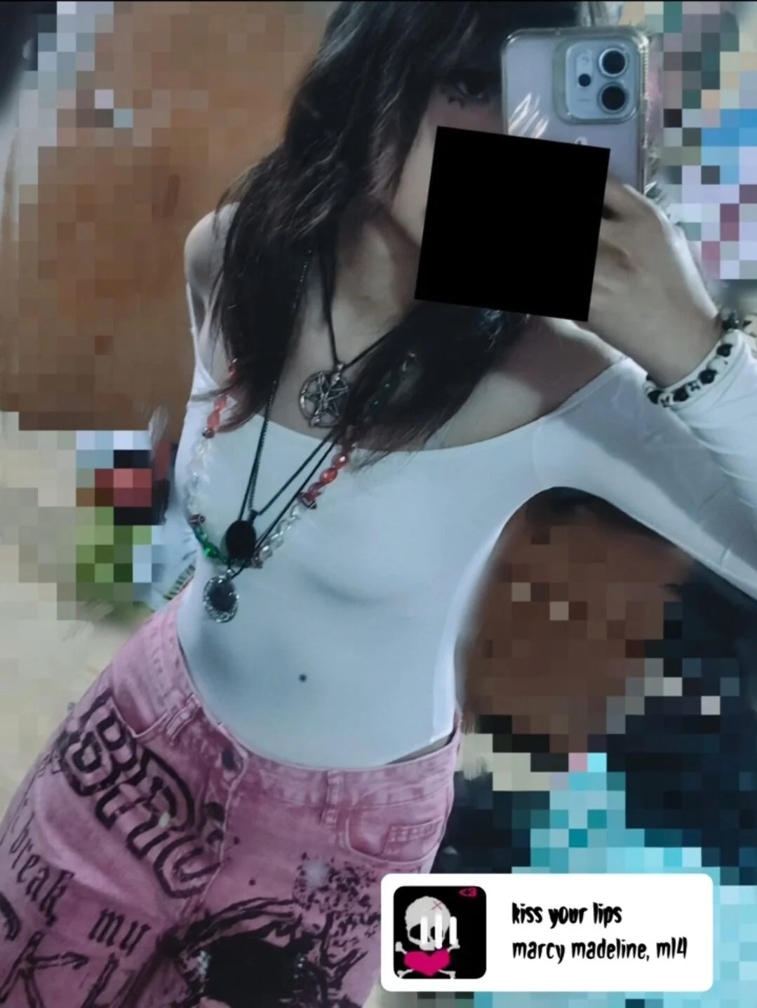 XXX Porn Photo of Nude Dermental 1