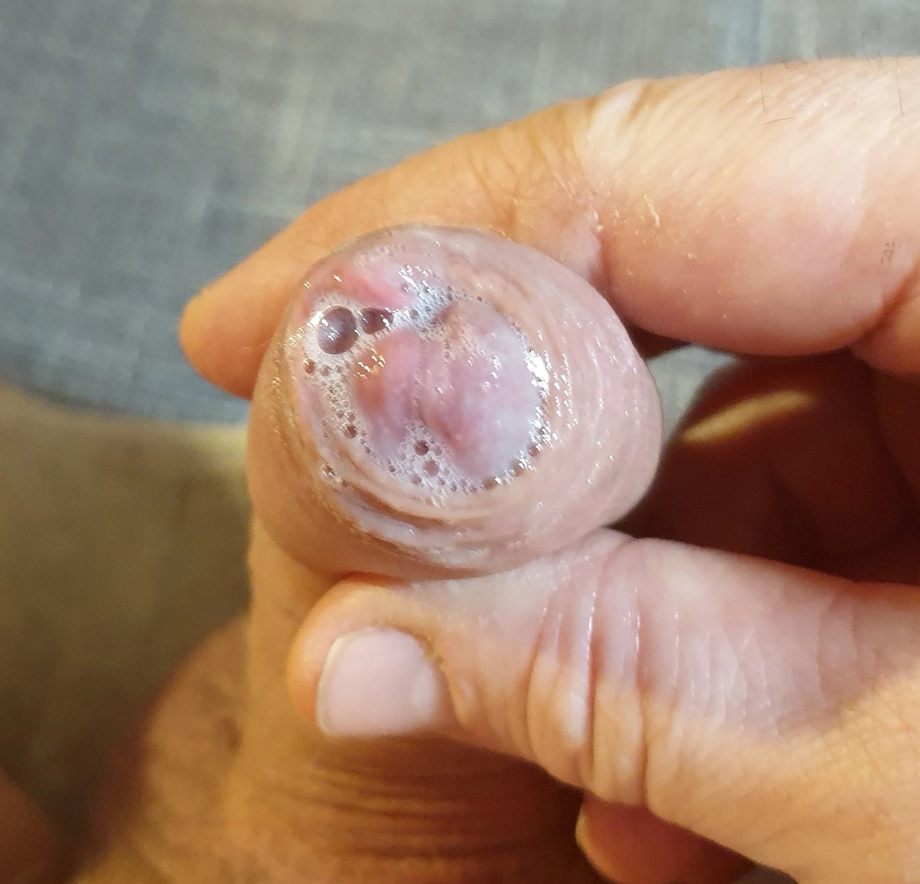 XXX Porn Photo of Nude pullerwichsi 4