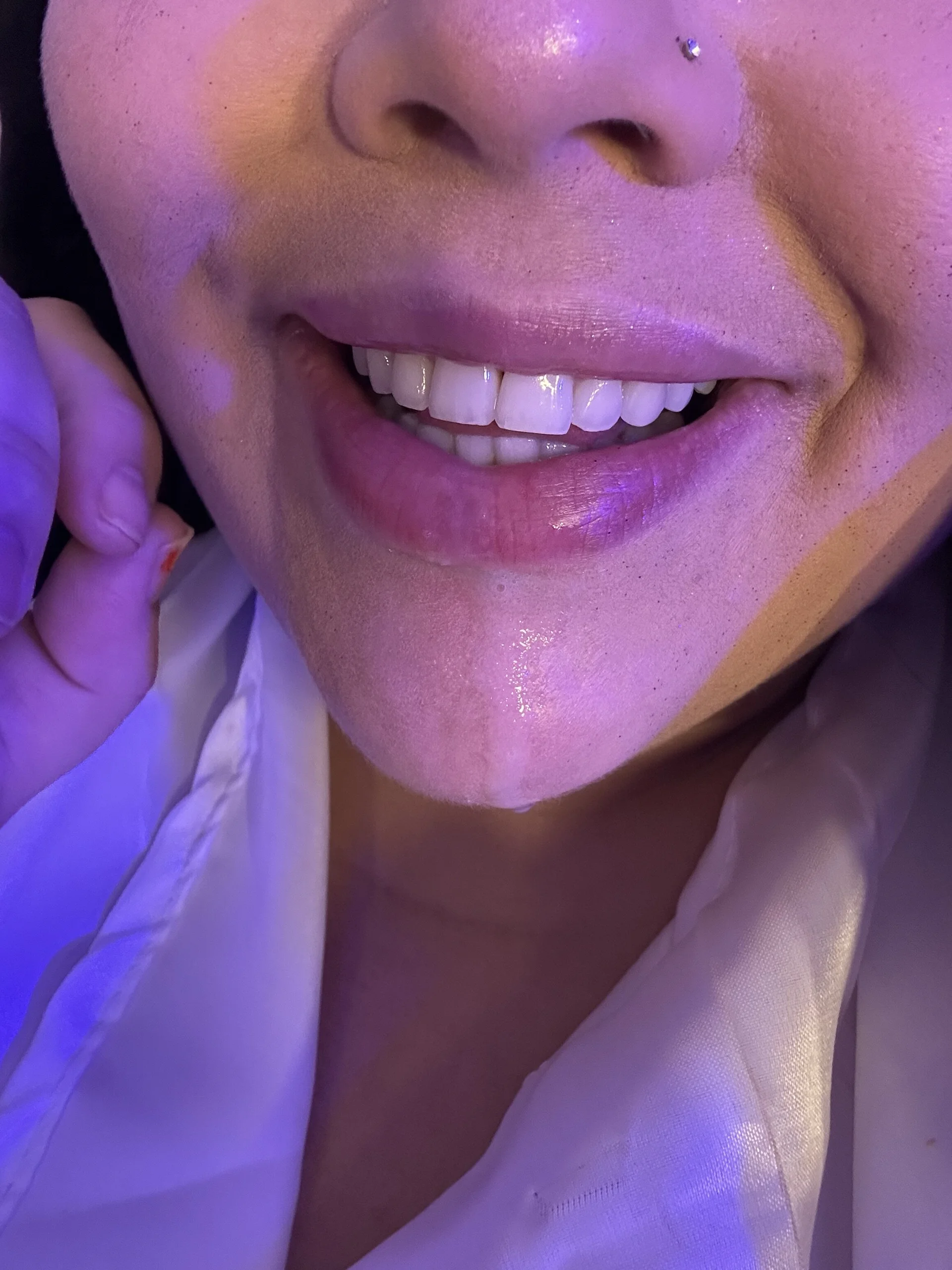 XXX Porn Photo of Nude Fernandinhacarioca021rj 16