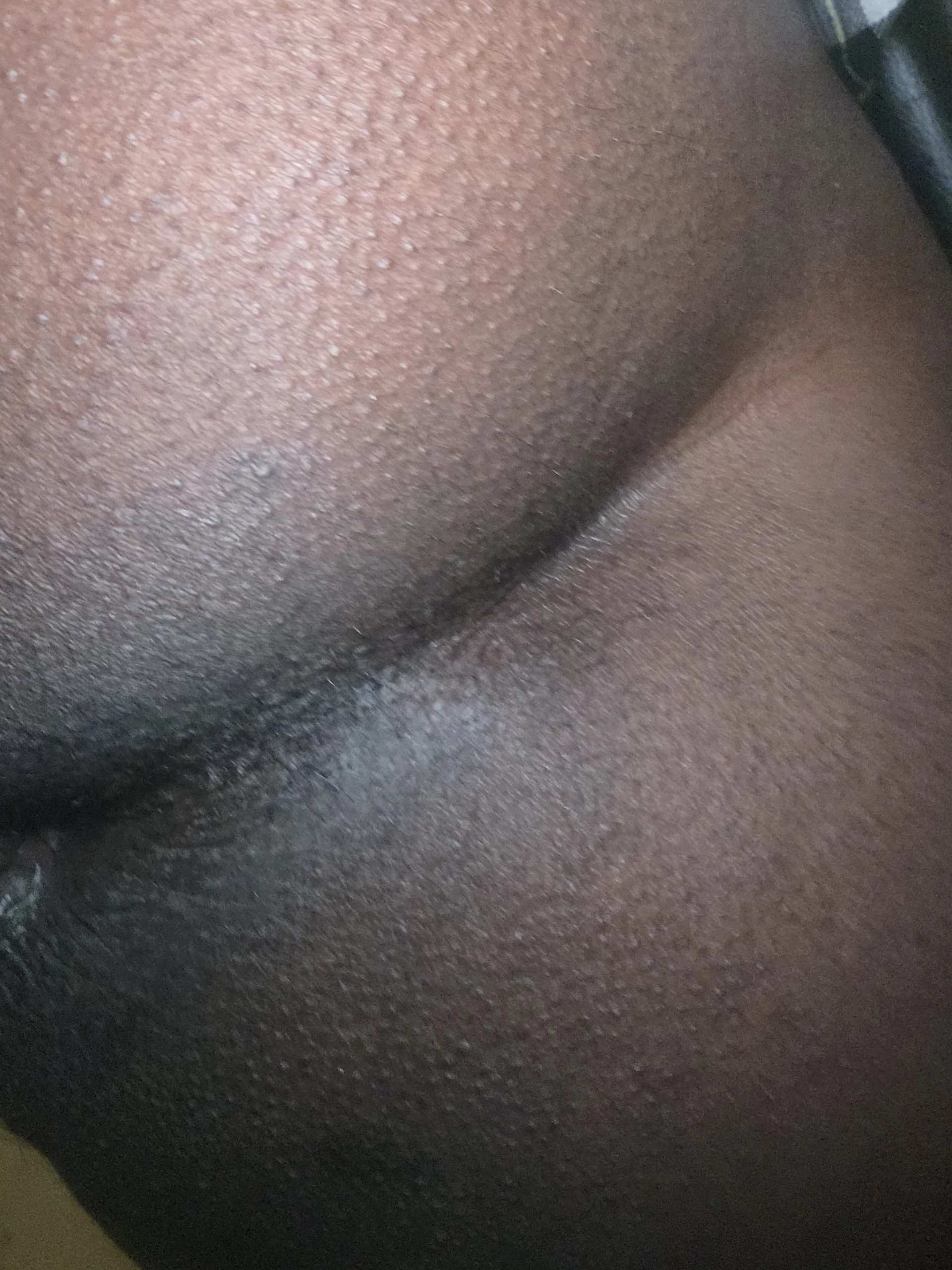 XXX Porn Photo of Nude Marl33_Ch33ks 12