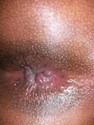 XXX Porn Photo of Nude hoittytoittyxx 2