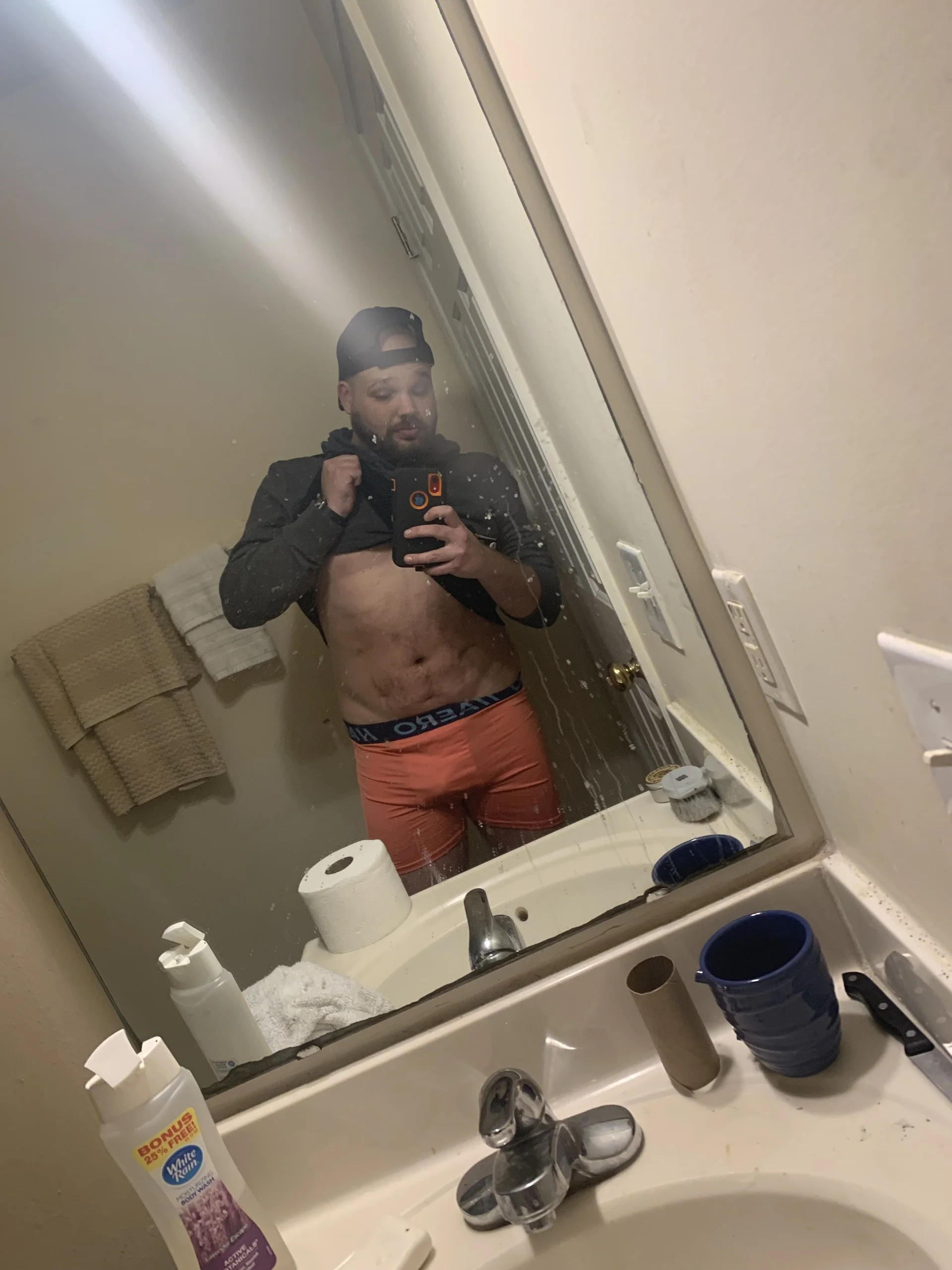 XXX Porn Photo of Nude Xstumpy 1