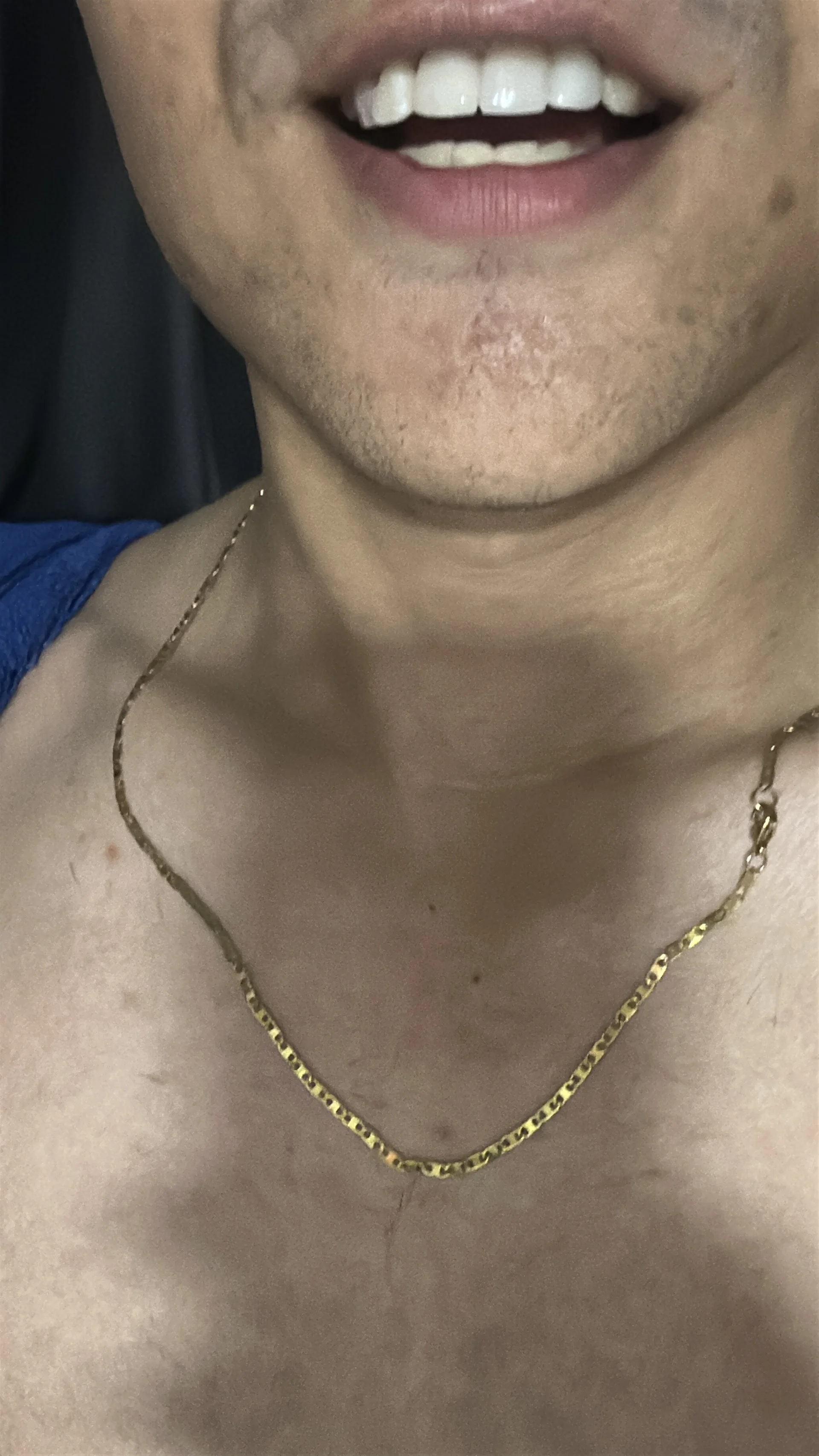 XXX Porn Photo of Nude CreamKingg 4