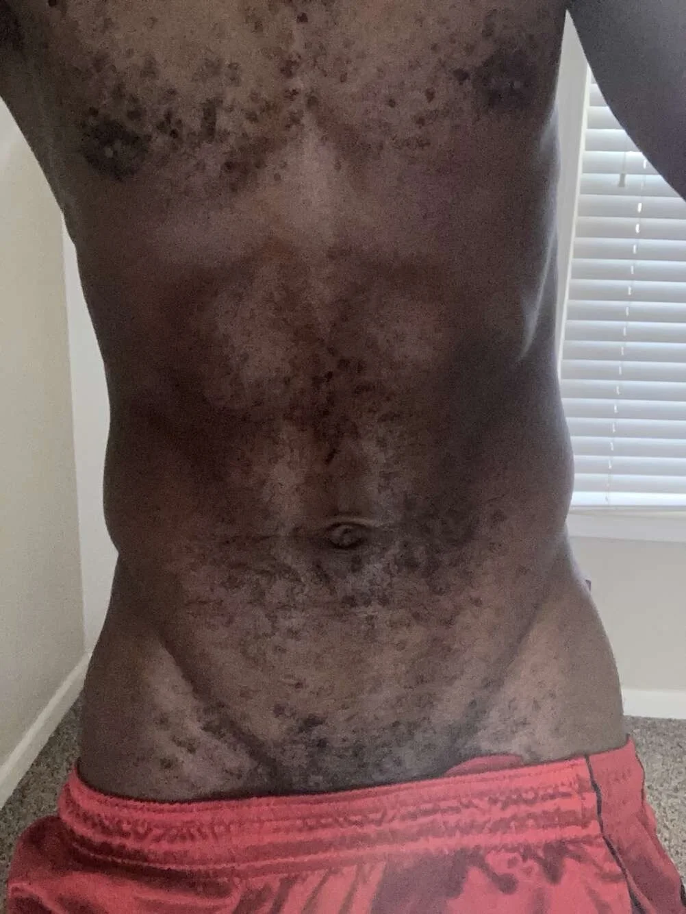 XXX Porn Photo of Nude razzynolight 6